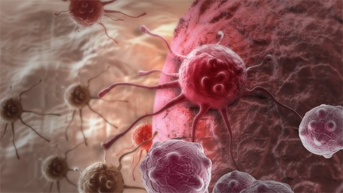Rise in number of people living with cancer