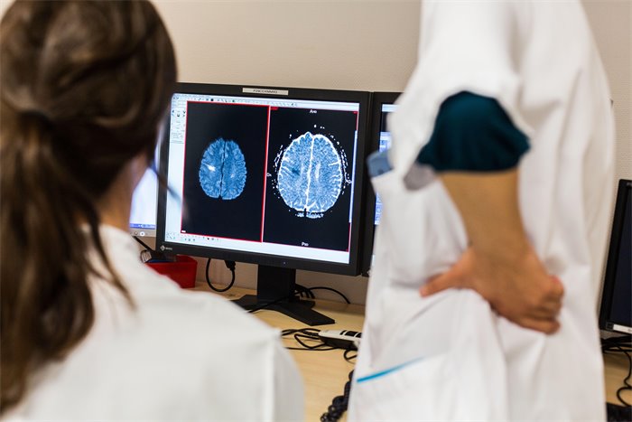 Ministers have ‘failed stroke survivors’ after missing target for seventh year