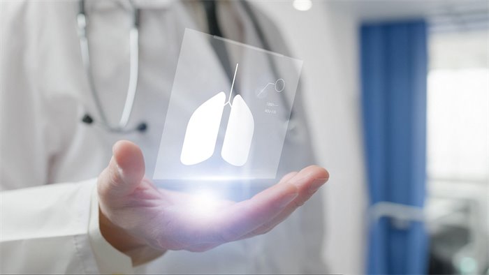 AI scanner could reduce lung cancer diagnosis time to ‘minutes’