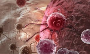 Cancer early detection targets missed