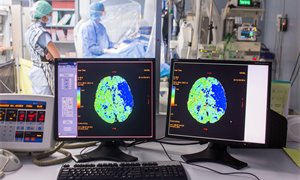 Dundee and US surgeons use a robot to perform world first stroke surgery